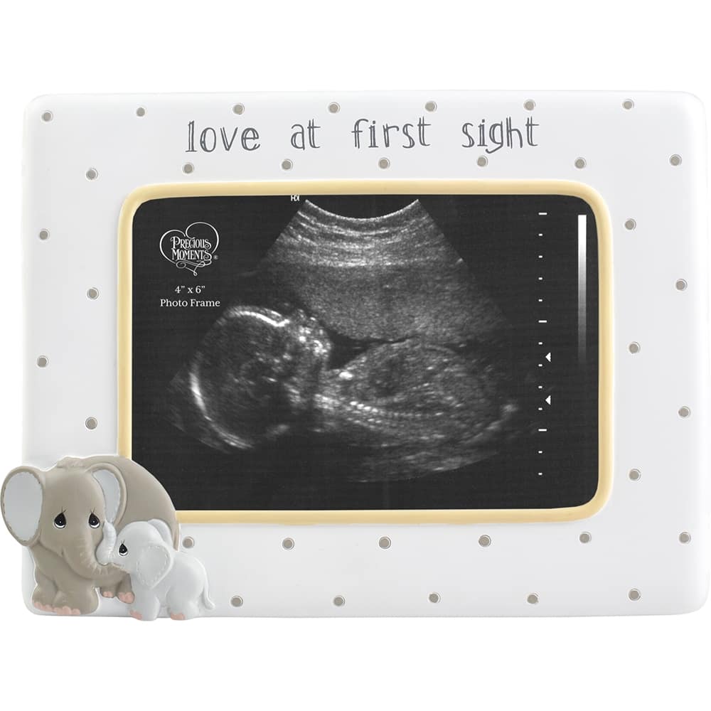 Michaels ultrasound on sale frame